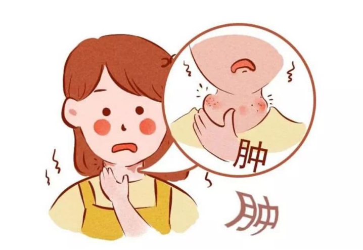 扁桃體發炎吃什么藥好得快？扁桃體發炎飲食禁忌有哪些？